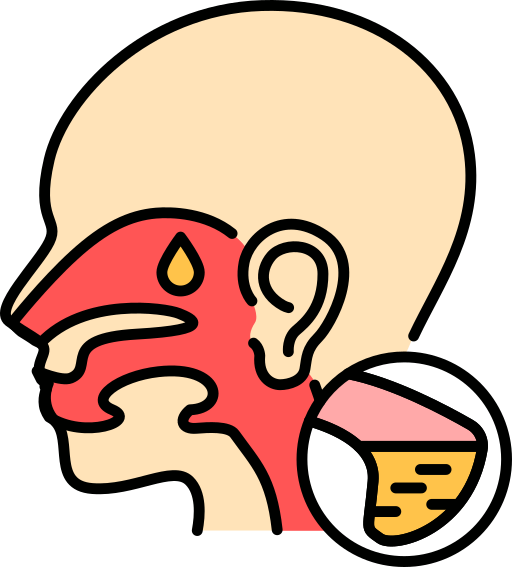 sinusitis