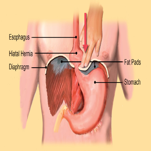 digestive-related-cause