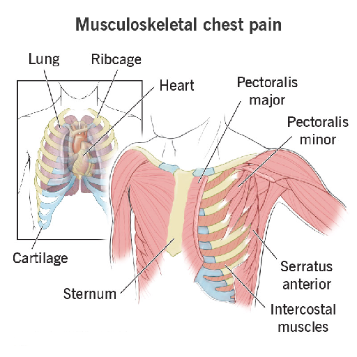 musculoskeletal
